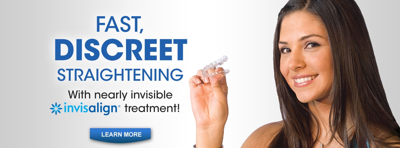 Invisalign Invisalign